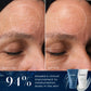Medik8 H.E.O. Mask before and after - 94% showed clinical improvement to skin moisturisation levels