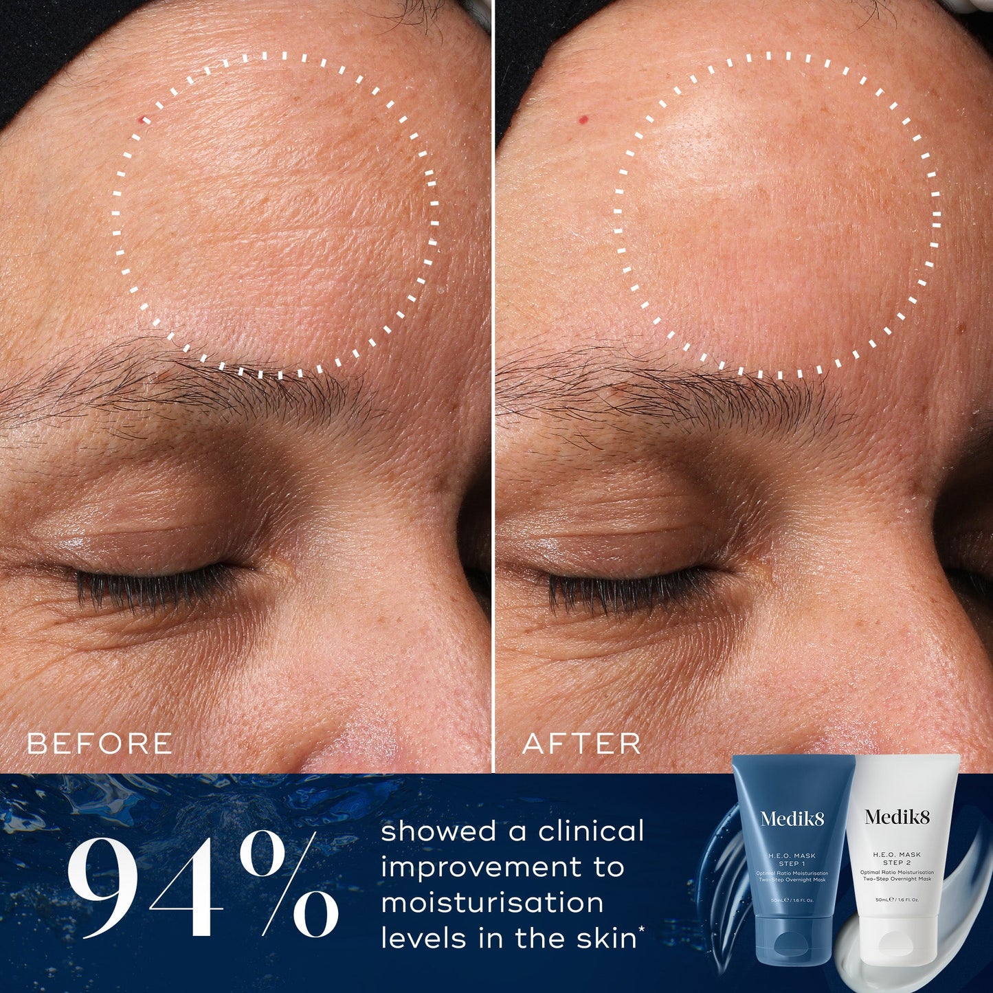Medik8 H.E.O. Mask before and after - 94% showed clinical improvement to skin moisturisation levels
