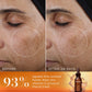 Medik8 Super C Ferulic 30ml before and after 28 days