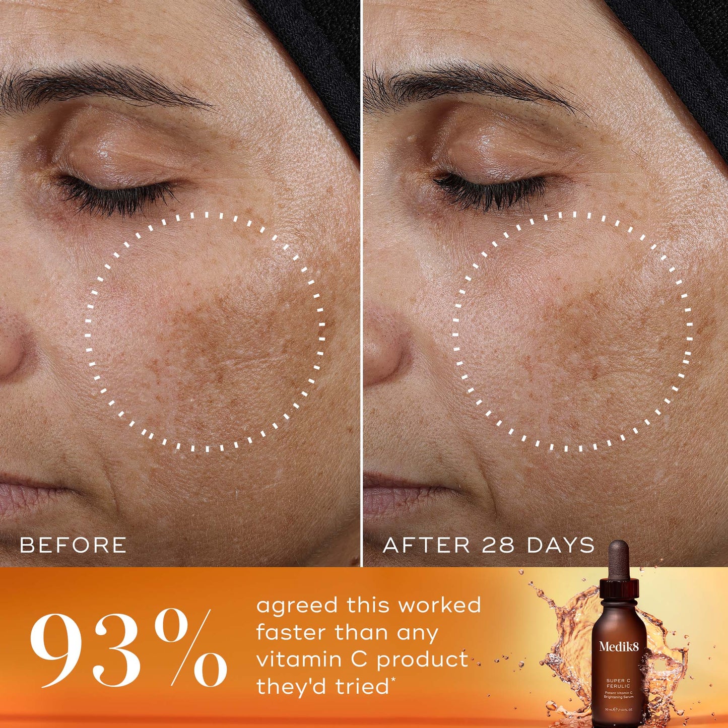 Medik8 Super C Ferulic 30ml before and after 28 days