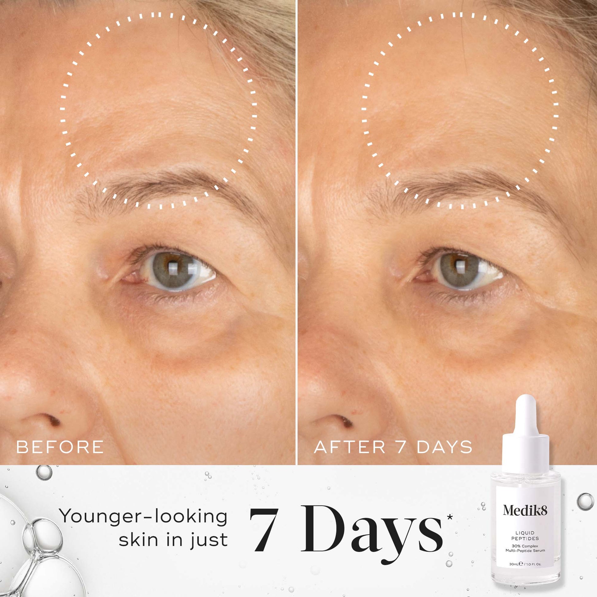 Medik8 Liquid Peptides before and after showing younger-looking skin in just 7 days