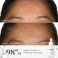Medik8 Liquid Peptides before and after after 28 days, 98% agree formula is instantly hydrating