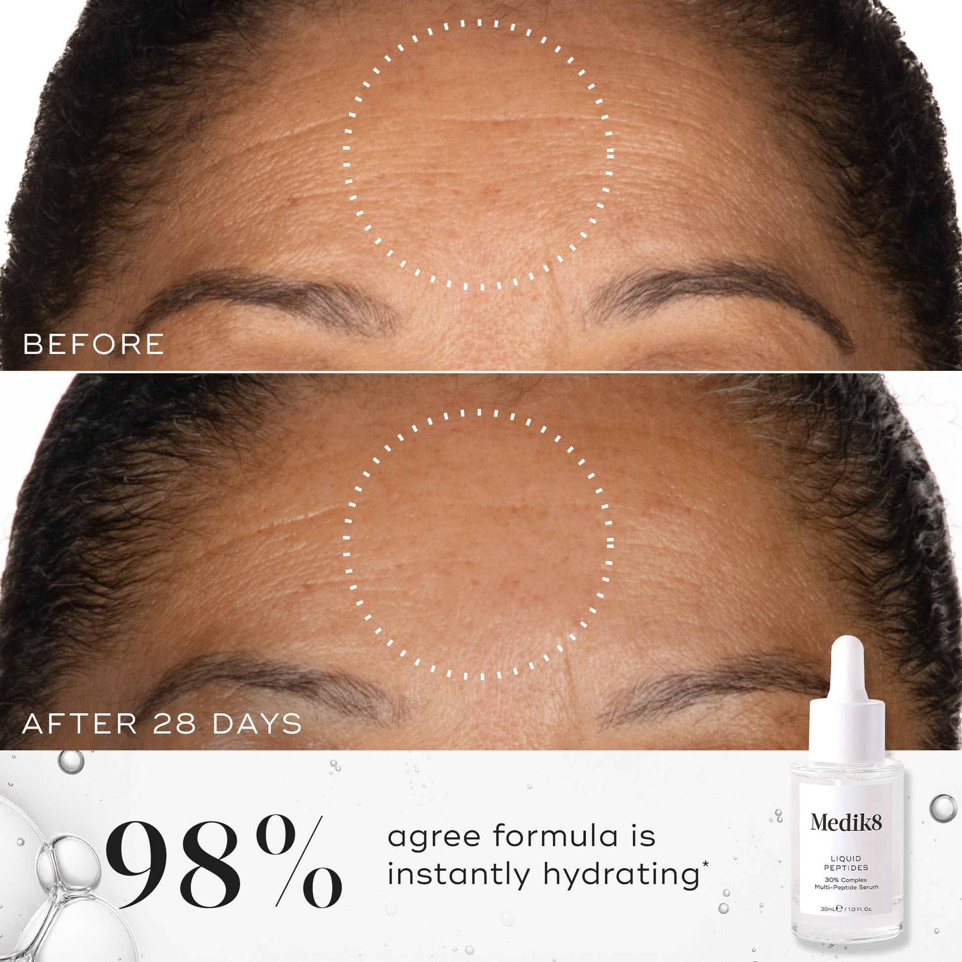 Medik8 Liquid Peptides before and after after 28 days, 98% agree formula is instantly hydrating
