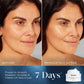 Medik8 Advanced Night Restore before and after comparison showing improved radiance and hydration