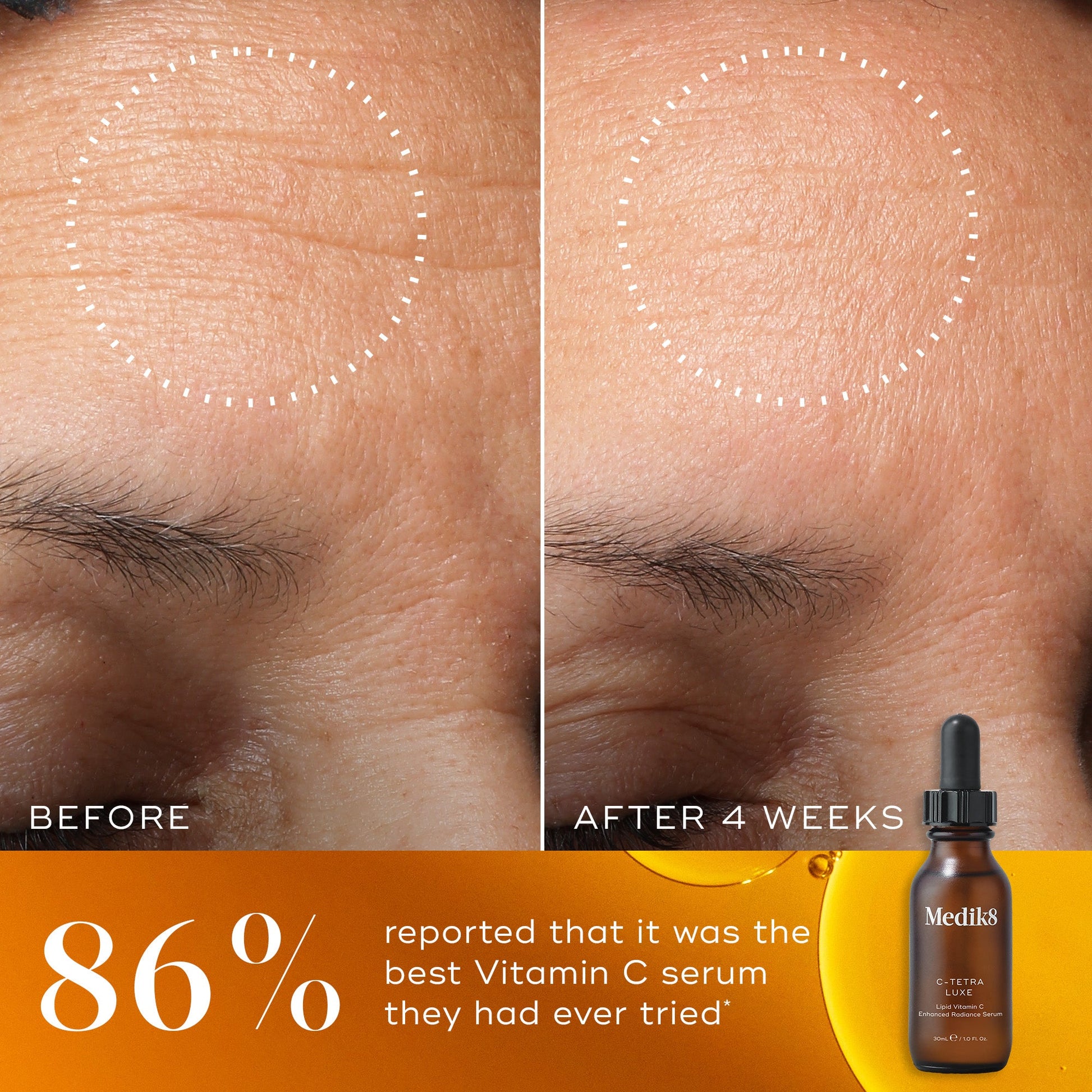 Medik8 C-Tetra Luxe before and after over 4 weeks showing reduced appearance of fine lines and wrinkles