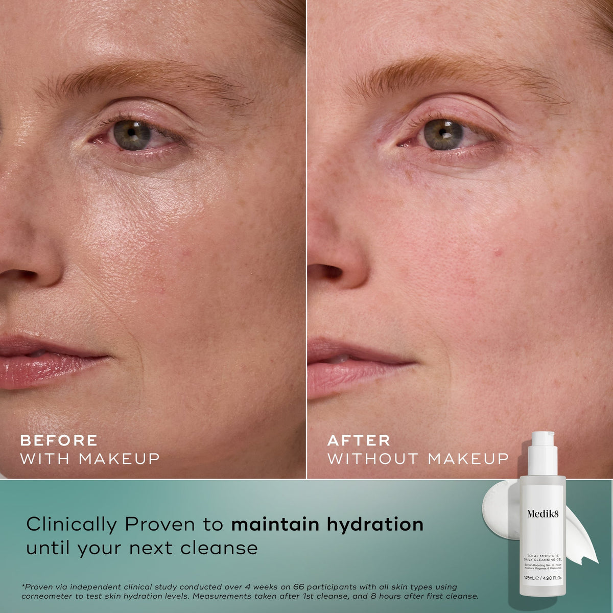 Medik8 Total Moisture Daily Cleansing Gel before and after